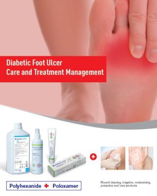 diabetic foot ulcer catalog